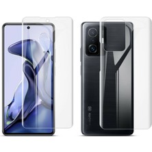Microcase Xiaomi 11T Pro Full Ön Arka Kaplama Tpu Soft Koruma Filmi