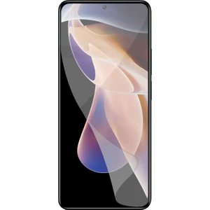 Case World Xiaomi Redmi Note 11 Pro Plus Nano Ekran Koruyucu Kırılmaz Esnek Cam