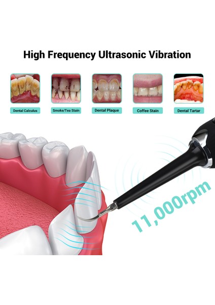 LED Elektrikli Taşınabilir Diş Temizleme Cihazı Diş Taşı Temizleyici Paslanmaz Çelik Diş Temizleme Cihazı Güzellik Diş Cihazı (Yurt Dışından)