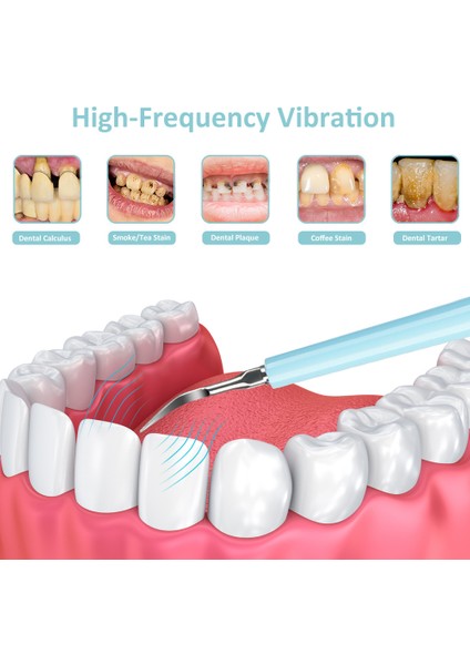 Yüksek Frekanslı Diş Temizleyici Elektrikli Diş Fırçası Seti Ev Diş Temizleme Aracı USB Şarj Edilebilir Diş Güzellik Aleti