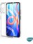 Xiaomi Redmi Note 11T Kılıf Transparent Soft Şeffaf 5