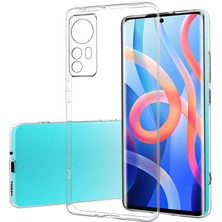 Casestreet Xiaomi 12 Kılıf Süper Silikon Korumalı Şeffaf+Full Ekran Koruyucu