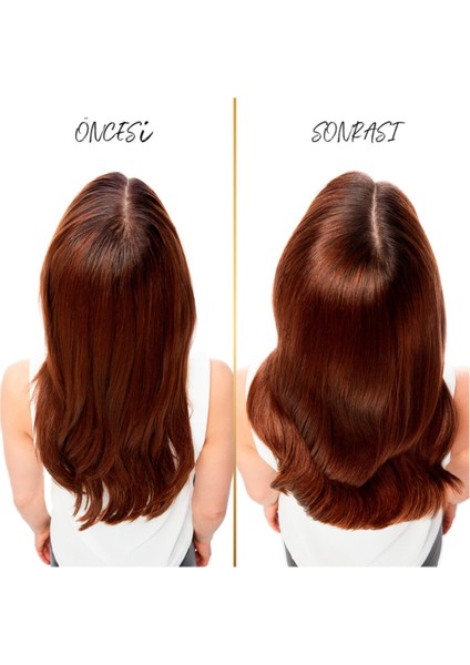 Şampuan Kepeğe Karşı Etkili 400 ml 3 Adet fiyatları