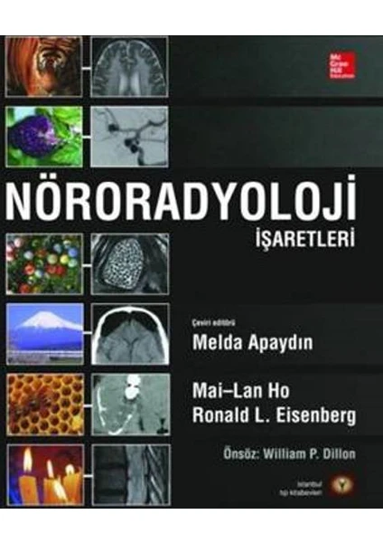 Nöroradyoloji İşaretleri (Ciltli)