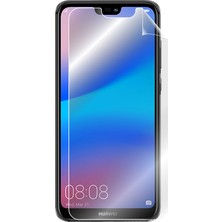 IPG Huawei P20 Lite 5.84" Görünmez Ekran Koruyucu