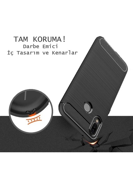 Xiaomi Mi 5S Room TPU Ultra Lüx Silikon Kılıf