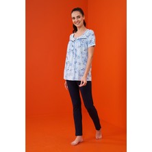 Pjs 23160 Kadın Patlı Pijama Takım
