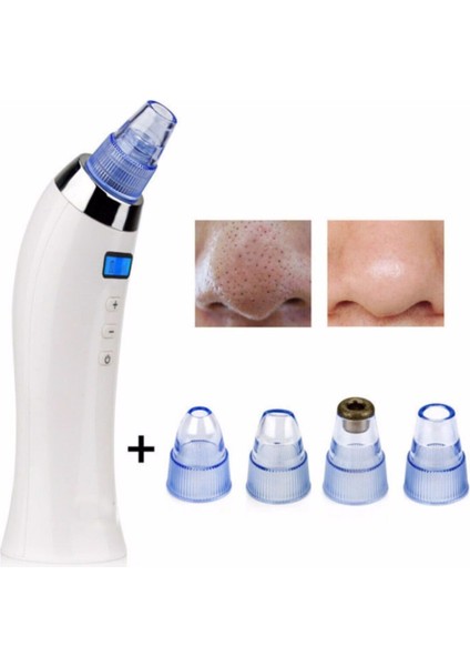 Xn 8030 Beautiful Skin Care Expert Şarjlı Vakumlu Siyah Nokta Cilt Temizleyici Yüz Temizleme
