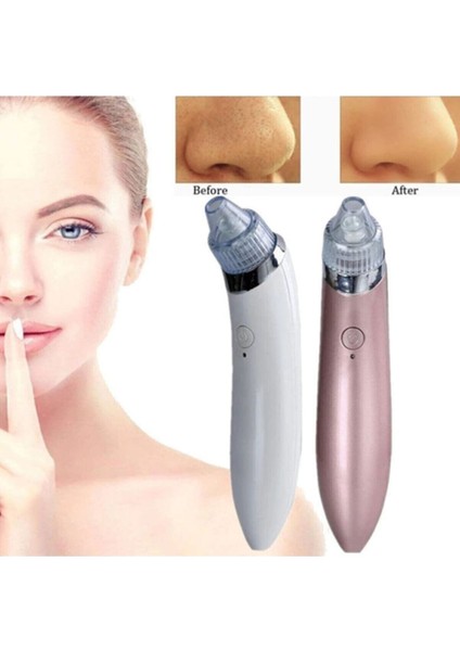 Vakumlu Siyah Nokta Temizleme Cihazı Find Back