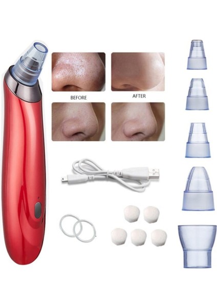 Vakumlu Siyah Nokta Temizleyici Yüz Vakum Gözenek Temizleyici Burun
