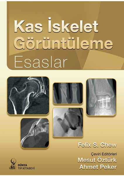 Kas İskelet Görüntüleme: Esaslar - Felix S. Chew