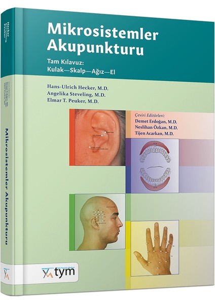 Mikrosistemler Akupunkturu