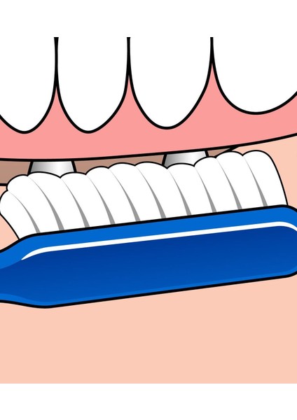 Diş Fırçası Implant Ortodontik modelleri
