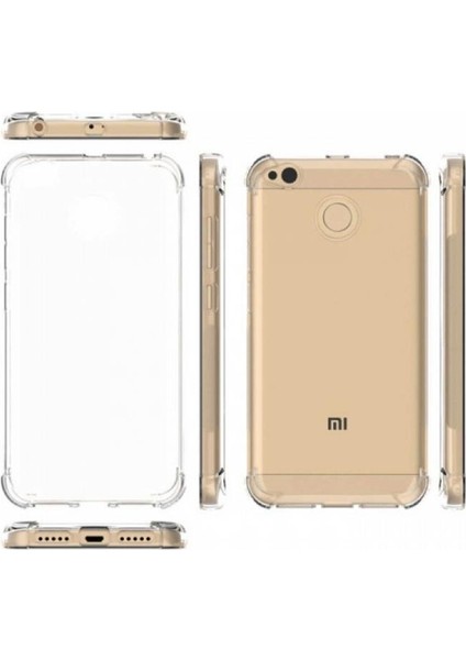 Xiaomi RedMi 4X Kılıf AntiShock Ultra Koruma Şeffaf