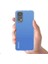 Xiaomi Redmi Note 11 Pro Kılıf Kamera Lens Korumalı Şeffaf Airbag Antishoock 2