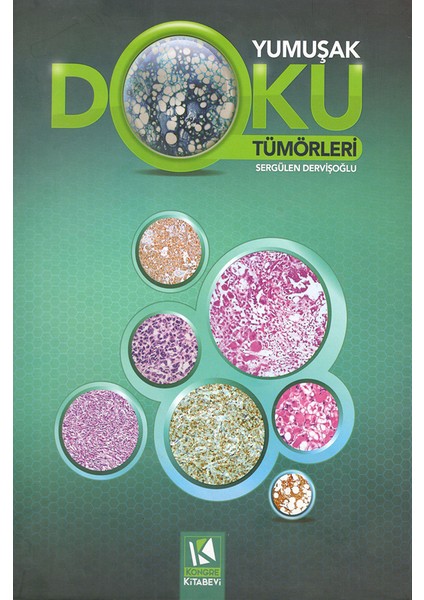 Yumuşak Doku Tümörleri