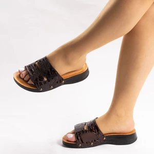 Kadın Hakiki Deri, Anatomik Hafızalı Tabanlıklı, Topuk Jeli Destekli, Kemik Çıkıntısı ve Topuk Dikeni Için Comfort Terlik