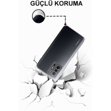 Caseworld Xiaomi Mi 11T 5g ile Uyumlu Kapak Tıpalı Kamera Korumalı Şeffaf Premier ile Uyumlu Kılıf
