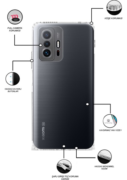 Caseworld Xiaomi Mi 11T 5g ile Uyumlu Kapak Tıpalı Kamera Korumalı Şeffaf Premier ile Uyumlu Kılıf
