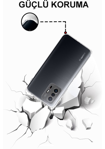 Caseworld Xiaomi Mi 11T 5g ile Uyumlu Kapak Tıpalı Kamera Korumalı Şeffaf Premier ile Uyumlu Kılıf