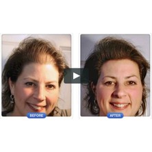 Dermmatch Açık Kahve