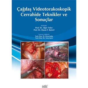 Çağdaş Videotorakoskopik Cerrahisinde Teknikler ve Sonuçlar