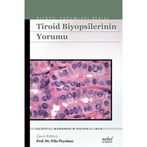 Tiroid Biyopsilerinin Yorumu - Biyopsi Yorumları Serisi