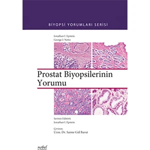 Prostat Biyopsilerinin Yorumu - Biyopsi Yorumları Serisi