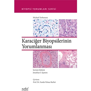 Karaciğer Biyopsilerinin Yorumlanması - Biyopsi Yorumları Serisi
