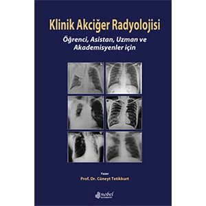 Klinik Akciğer Radyolojisi: Öğrenci, Asistan, Uzman ve Akademisyenler için