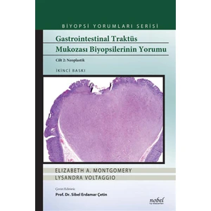 Gastrointestinal Traktüs Mukozası Biyopsilerinin Yorumu Cilt 2: Neoplastik - Biyopsi Yorumları Serisi