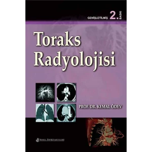 Toraks Radyolojisi