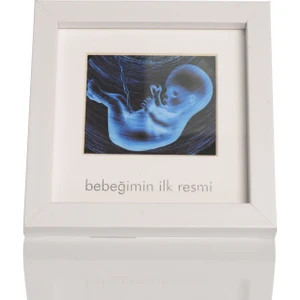 Bebeğimin İlk Resmi Ultrason Çerçeve