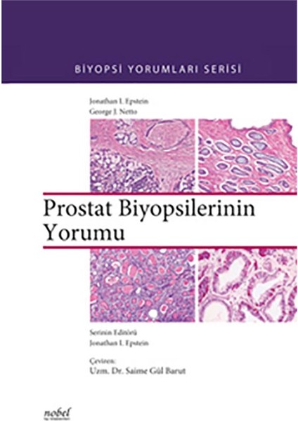Prostat Biyopsilerinin Yorumu - Biyopsi Yorumları Serisi