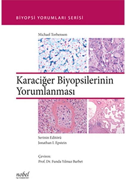 Karaciğer Biyopsilerinin Yorumlanması - Biyopsi Yorumları Serisi