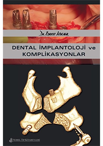 Dental İmplantoloji ve Komplikasyonlar