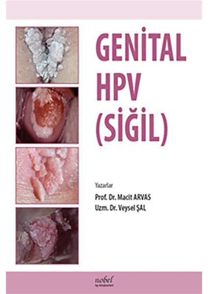 Genital HPV SİĞİL