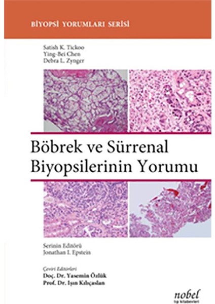 Böbrek ve Sürrenal Biyopsilerinin Yorumu - Biyopsi Yorumları Serisi