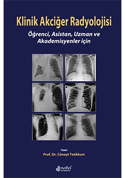 Klinik Akciğer Radyolojisi: Öğrenci, Asistan, Uzman ve Akademisyenler için