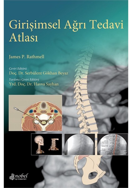 Girişimsel Ağrı Tedavi Atlası