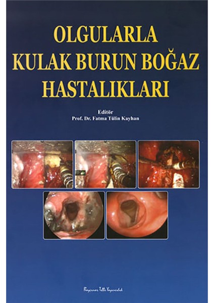 Olgularla Kulak Burun Boğaz Hastalıkları