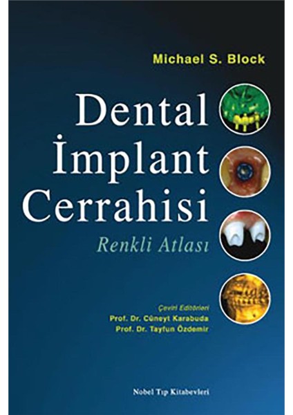 Dental İmplant Cerrahisi Renkli Atlası