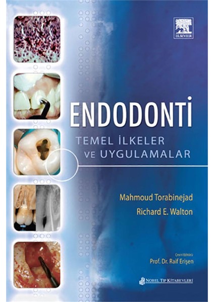 Endodonti Temel İlkeler ve Uygulamalar