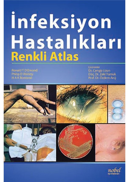 İnfeksiyon Hastalıkları: Renkli Atlas