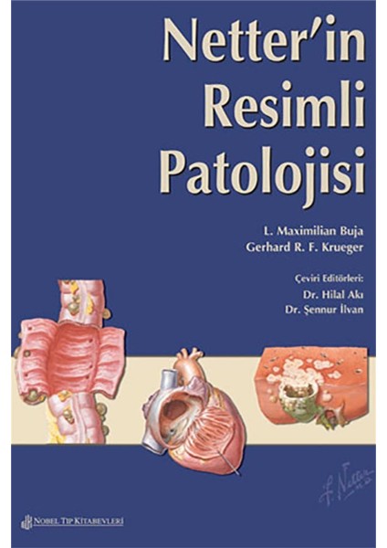 Netter'in Resimli Patolojisi