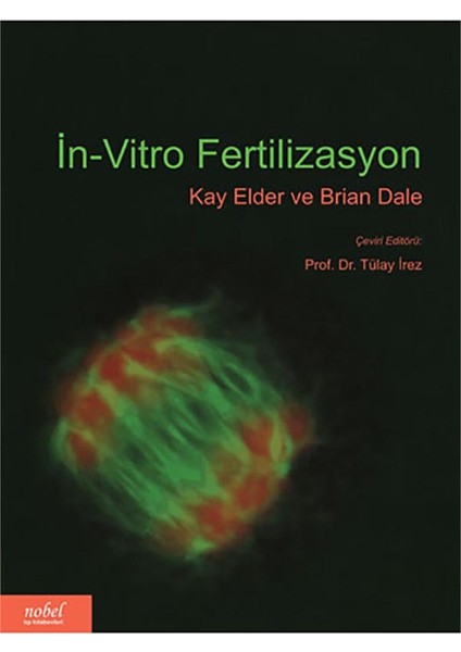 İn-Vitro Fertilizasyon