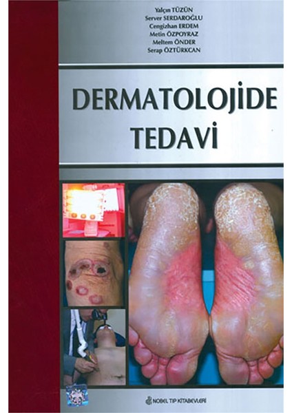 Dermatolojide Tedavi