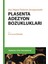 Plasenta Adezyon Bozuklukları 1