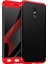 Xiaomi Redmi Note 4 Kılıf Double Dip 360 Protective 2