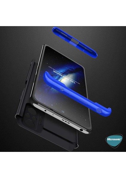 Xiaomi Redmi Note 10 Pro Max Kılıf Double Dip 360 Protective Rose Gold